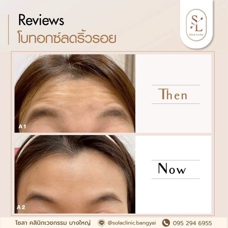 SOLA CLINIC (Bangyai Branch) SOLA CLINIC - โซลา คลินิกเวชกรรม สาขาบางใหญ่ image_picker_BDF63A39-E154-43D2-B626-ED203BDAE3D8-90611-00000B6C6942D616