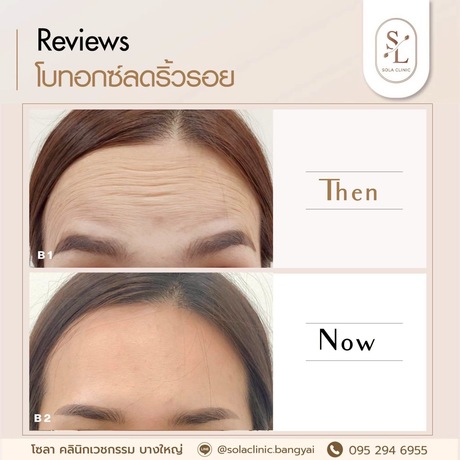 SOLA CLINIC (Bangyai Branch) SOLA CLINIC - โซลา คลินิกเวชกรรม สาขาบางใหญ่ image_picker_76150A58-2DB3-4E65-9A86-880A8DC1D8BB-90611-00000B6C69830C2A