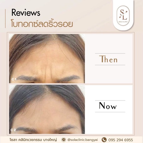 SOLA CLINIC (Bangyai Branch) SOLA CLINIC - โซลา คลินิกเวชกรรม สาขาบางใหญ่ image_picker_FCCEFE41-7DF2-425A-9B6B-4B5C586BDC1F-90611-00000B6C6973FE74