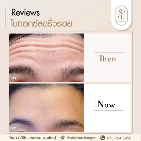 SOLA CLINIC (Bangyai Branch) SOLA CLINIC - โซลา คลินิกเวชกรรม สาขาบางใหญ่ image_picker_10D1F488-B674-44A6-A72A-7AC504C670F2-90611-00000B6C69AFA08B