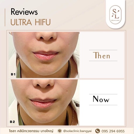 SOLA CLINIC (Bangyai Branch) SOLA CLINIC - โซลา คลินิกเวชกรรม สาขาบางใหญ่ image_picker_8ECC253D-AE7D-48C1-BF7C-D167628D6D39-90611-00000B6C69EC5441