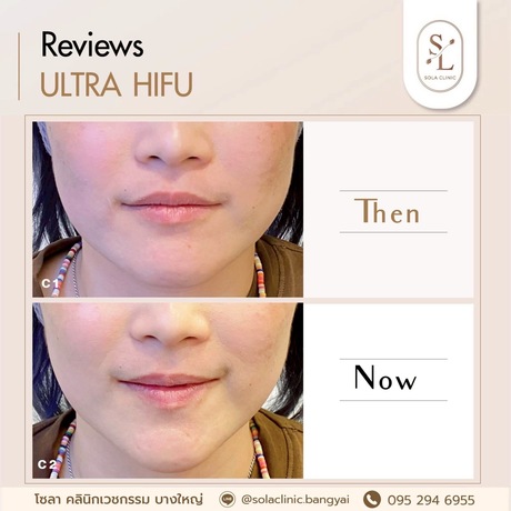 SOLA CLINIC (Bangyai Branch) SOLA CLINIC - โซลา คลินิกเวชกรรม สาขาบางใหญ่ image_picker_9F13E10D-0C1B-4F6B-824D-AD62A5A7FB4B-90611-00000B6C6A27E2A6