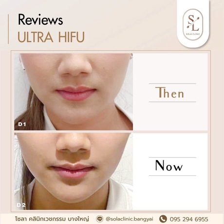 SOLA CLINIC (Bangyai Branch) SOLA CLINIC - โซลา คลินิกเวชกรรม สาขาบางใหญ่ image_picker_7174A501-D307-48BF-8543-ABA044AC936C-90611-00000B6C69E004E8