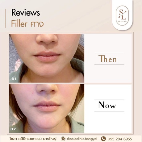 SOLA CLINIC (Bangyai Branch) SOLA CLINIC - โซลา คลินิกเวชกรรม สาขาบางใหญ่ image_picker_15BF8EF8-B0A6-4127-8342-B07ECB5567E0-90611-00000B6C6A0EE20E
