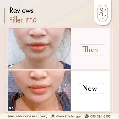 SOLA CLINIC (Bangyai Branch) SOLA CLINIC - โซลา คลินิกเวชกรรม สาขาบางใหญ่ image_picker_9B29F5F9-620B-4B4F-BD65-F319033E86D5-90611-00000B6C6A1B1347