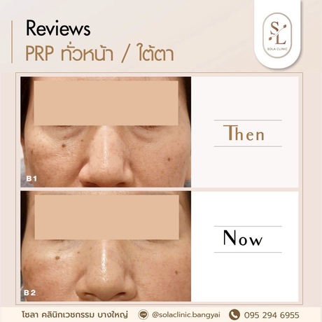 SOLA CLINIC (Bangyai Branch) SOLA CLINIC - โซลา คลินิกเวชกรรม สาขาบางใหญ่ image_picker_3C036628-7052-42FB-8232-5E6A1974231D-90611-00000B6C6ACB9BC1