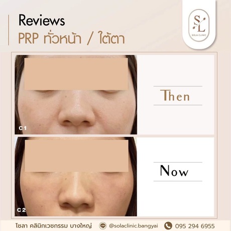 SOLA CLINIC (Bangyai Branch) SOLA CLINIC - โซลา คลินิกเวชกรรม สาขาบางใหญ่ image_picker_6B0B130E-5F8C-42FB-9602-8BCF14CB38CA-90611-00000B6C6A336B71