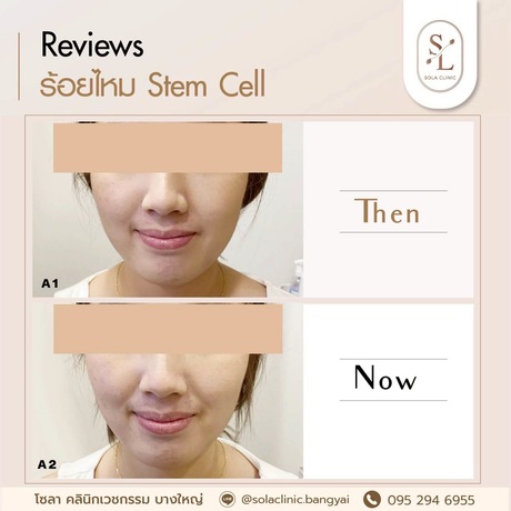 SOLA CLINIC (Bangyai Branch) SOLA CLINIC - โซลา คลินิกเวชกรรม สาขาบางใหญ่ image_picker_CB9F01CF-DE07-4540-B3B9-4346602E2873-90611-00000B6C6A560855