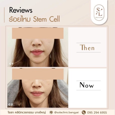 SOLA CLINIC (Bangyai Branch) SOLA CLINIC - โซลา คลินิกเวชกรรม สาขาบางใหญ่ image_picker_F7CE1310-4FFD-47CB-B2AC-9D89B5C72F5A-90611-00000B6C6A7943D2