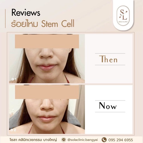 SOLA CLINIC (Bangyai Branch) SOLA CLINIC - โซลา คลินิกเวชกรรม สาขาบางใหญ่ image_picker_4CE2DA03-CF60-4F02-BD21-EFE614D4ADC6-90611-00000B6C6A84BCA2