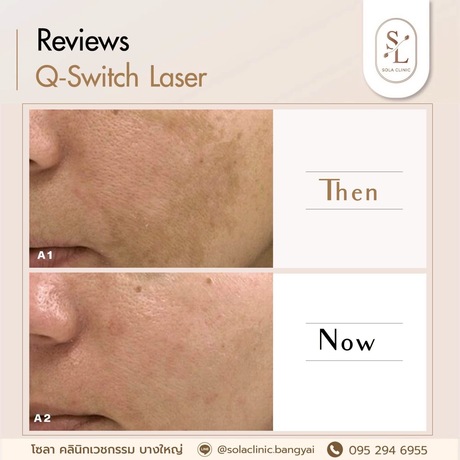 SOLA CLINIC (Bangyai Branch) SOLA CLINIC - โซลา คลินิกเวชกรรม สาขาบางใหญ่ image_picker_BE661BBA-BD1F-491C-B9A3-B73780A032B0-90611-00000B6C6AA817FA