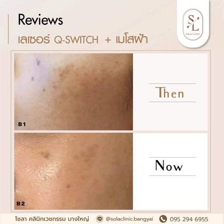 SOLA CLINIC (Bangyai Branch) SOLA CLINIC - โซลา คลินิกเวชกรรม สาขาบางใหญ่ image_picker_532D72AE-A19B-4CFF-A0B1-8B9CB2242D3D-90611-00000B6C6A9C208D