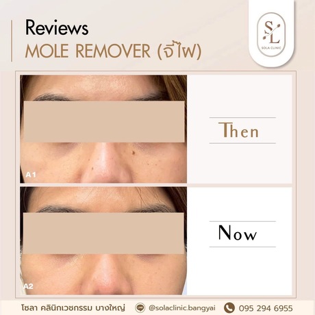 SOLA CLINIC (Bangyai Branch) SOLA CLINIC - โซลา คลินิกเวชกรรม สาขาบางใหญ่ image_picker_2E3A8CF0-DCA1-418E-96B4-590D17AF6D63-90611-00000B6C6A907120