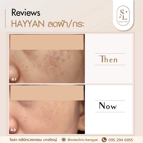 SOLA CLINIC (Bangyai Branch) SOLA CLINIC - โซลา คลินิกเวชกรรม สาขาบางใหญ่ image_picker_A64B7916-38A6-42ED-B070-C2624F1E3EC8-90611-00000B6C6AD66819