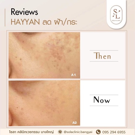 SOLA CLINIC (Bangyai Branch) SOLA CLINIC - โซลา คลินิกเวชกรรม สาขาบางใหญ่ image_picker_DF2D57A0-C8A0-49A0-9B29-46B8BFED68C1-90611-00000B6C6AB3D64C