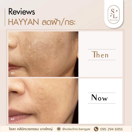 SOLA CLINIC (Bangyai Branch) SOLA CLINIC - โซลา คลินิกเวชกรรม สาขาบางใหญ่ image_picker_E8575420-2DC1-4F3A-BC05-3F5F8F8D9393-90611-00000B6C6AC0280B