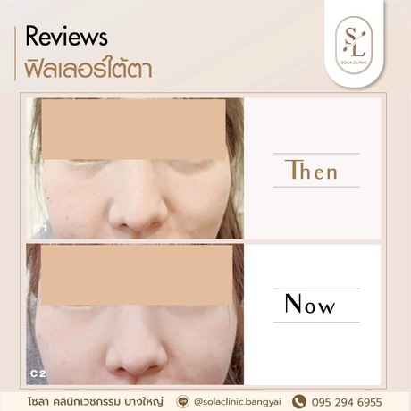 SOLA CLINIC (Bangyai Branch) SOLA CLINIC - โซลา คลินิกเวชกรรม สาขาบางใหญ่ image_picker_6C62601A-DA0D-4E2A-8F9A-E324D3475414-90611-00000B6C6B1AD25E