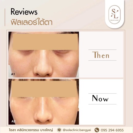 SOLA CLINIC (Bangyai Branch) SOLA CLINIC - โซลา คลินิกเวชกรรม สาขาบางใหญ่ image_picker_D4429559-109D-4CBB-90E6-1DD5B422EC26-90611-00000B6C6B5F7C85