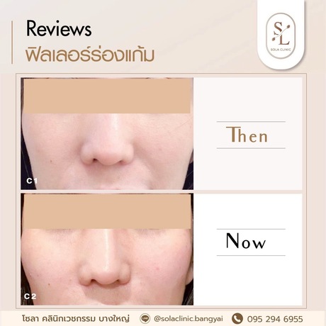 SOLA CLINIC (Bangyai Branch) SOLA CLINIC - โซลา คลินิกเวชกรรม สาขาบางใหญ่ image_picker_10450407-68CD-44B9-A79D-CC32D820BE0E-90611-00000B6C6B3BFBB1