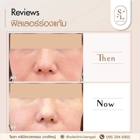 SOLA CLINIC (Bangyai Branch) SOLA CLINIC - โซลา คลินิกเวชกรรม สาขาบางใหญ่ image_picker_9CCCC3CF-400F-4BB3-BAF8-CDB2BE691E07-90611-00000B6C6B6B4E2F