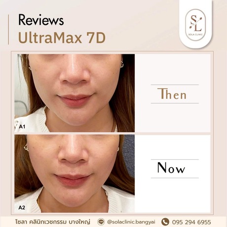SOLA CLINIC (Bangyai Branch) SOLA CLINIC - โซลา คลินิกเวชกรรม สาขาบางใหญ่ image_picker_083471AA-646D-4576-B0EA-467ED38F8D2D-90611-00000B6C6B843A16