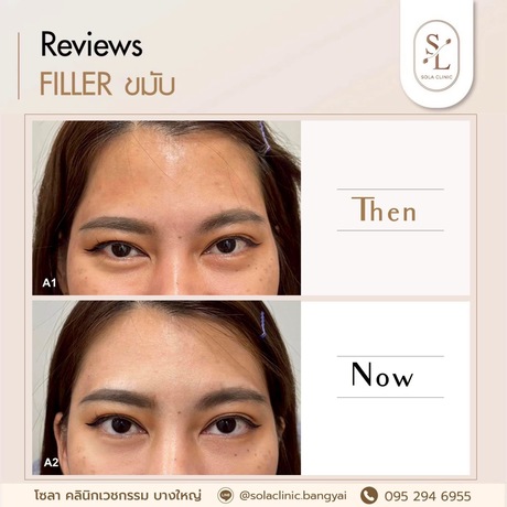 SOLA CLINIC (Bangyai Branch) SOLA CLINIC - โซลา คลินิกเวชกรรม สาขาบางใหญ่ image_picker_205B1B43-896C-4ED9-8CB8-950134886235-90611-00000B6C6BE5F1B3