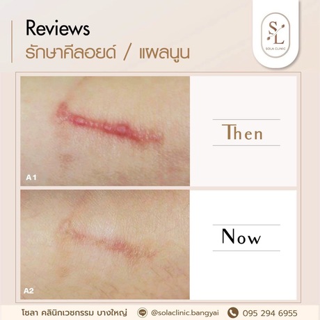 SOLA CLINIC (Bangyai Branch) SOLA CLINIC - โซลา คลินิกเวชกรรม สาขาบางใหญ่ image_picker_3CFF92D6-1467-4750-99E8-D1483DD492B4-90611-00000B6C6B906862