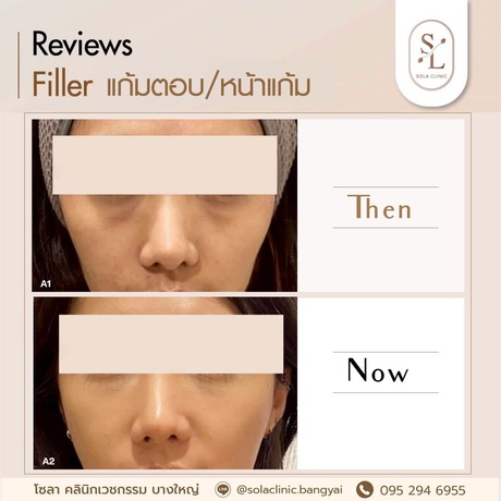SOLA CLINIC (Bangyai Branch) SOLA CLINIC - โซลา คลินิกเวชกรรม สาขาบางใหญ่ image_picker_2DC8C47A-A8D7-4F03-90C1-F87A50E91CA1-90611-00000B6C6BA77A70
