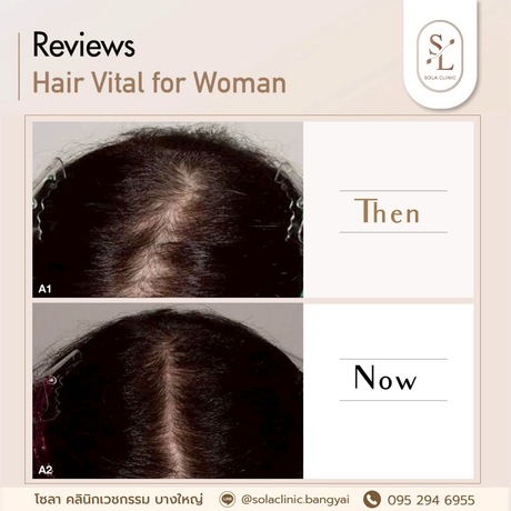 SOLA CLINIC (Bangyai Branch) SOLA CLINIC - โซลา คลินิกเวชกรรม สาขาบางใหญ่ image_picker_18C98FDF-C325-4A37-A35A-C8A35699CC75-90611-00000B6C6C1B4DB6