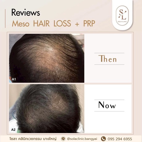 SOLA CLINIC (Bangyai Branch) SOLA CLINIC - โซลา คลินิกเวชกรรม สาขาบางใหญ่ image_picker_7F79A96F-36C0-4B4C-9C55-B9B01DB6A41C-90611-00000B6C6BB511B8