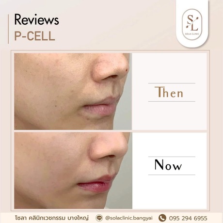 SOLA CLINIC (Bangyai Branch) SOLA CLINIC - โซลา คลินิกเวชกรรม สาขาบางใหญ่ image_picker_6C0276E7-B83A-4FAA-8E52-D6BE84876367-90611-00000B6C6C33A998