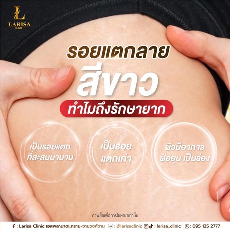 Larisa Clinic (Esplanade) ลาริสาคลินิกเวชกรรม สาขา Esplanade แคราย - งามวงศ์วาน ช้้น 2 S__49979403