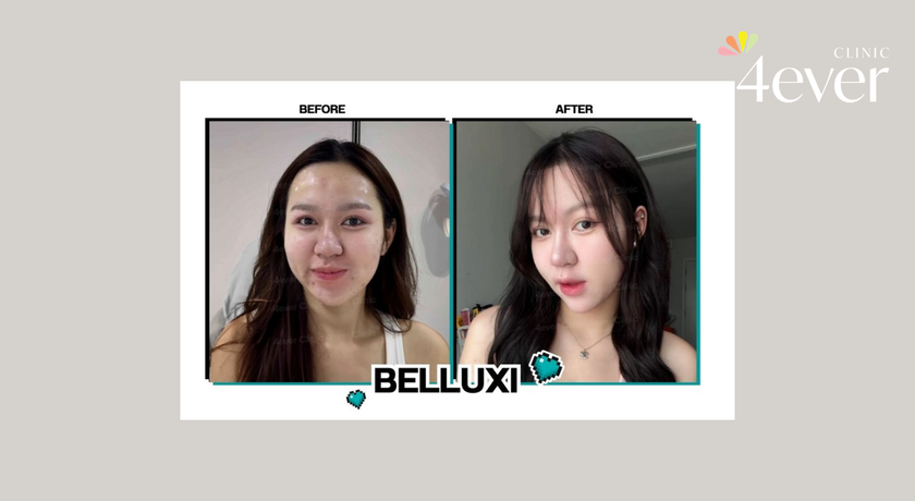 4ever Clinic Thailand (Siam Square Soi 6) 4ever Clinic Thailand - โฟร์เอเวอร์ คลินิก ไทยแลนด์ สยามสแควร์ ซอย 6 คลินิกความงาม 10