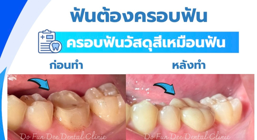 Do Fun Dee Dental Clinic Do Fun Dee Dental Clinic - คลินิกทันตกรรมดูฟันดี ทำฟันครบวงจรชลบุรี 8