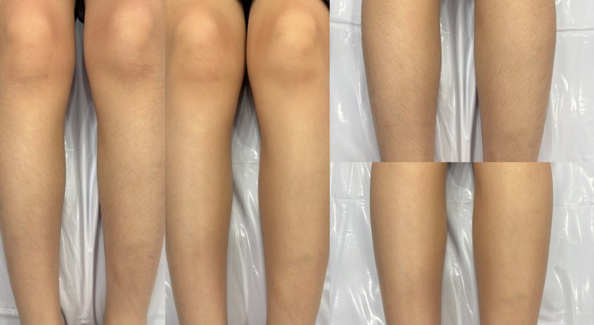 Ani Clinic by Anika (Avenue Ratchayothin Branch) Ani Clinic by Anika - อานิ คลินิก บาย อนิกา (Avenue Ratchayothin) 8