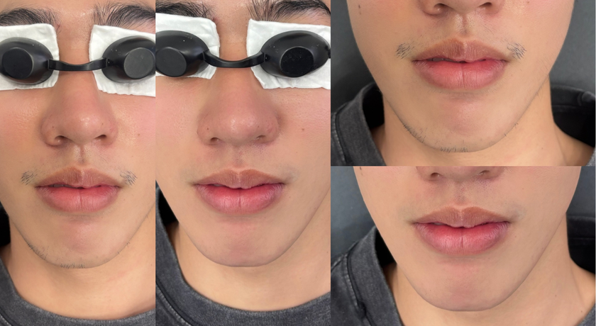 Ani Clinic by Anika (Avenue Ratchayothin Branch) Ani Clinic by Anika - อานิ คลินิก บาย อนิกา (Avenue Ratchayothin) 9