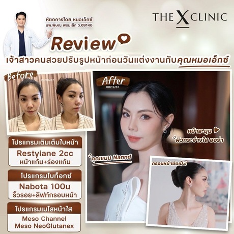 The X Clinic (JAS Green Village Ramkhamhaeng) The X Clinic (Jas Green Village) - ดิ เอ็กซ์ คลินิก บริการเสริมความงามครบวงจร รามคำแหง image_picker_496338A2-09A0-479B-B9A3-D81A3418D096-19495-0000195F2F3F73EC