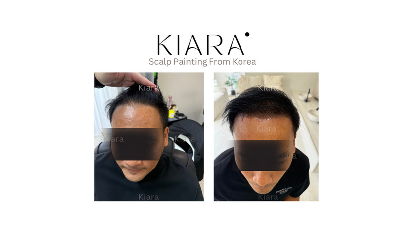 Kiara Scalp Painting (Ratchaphruek) Kiara Scalp Painting - เคียร์ร่า เพ้นท์สีผม ราชพฤกษ์ 3