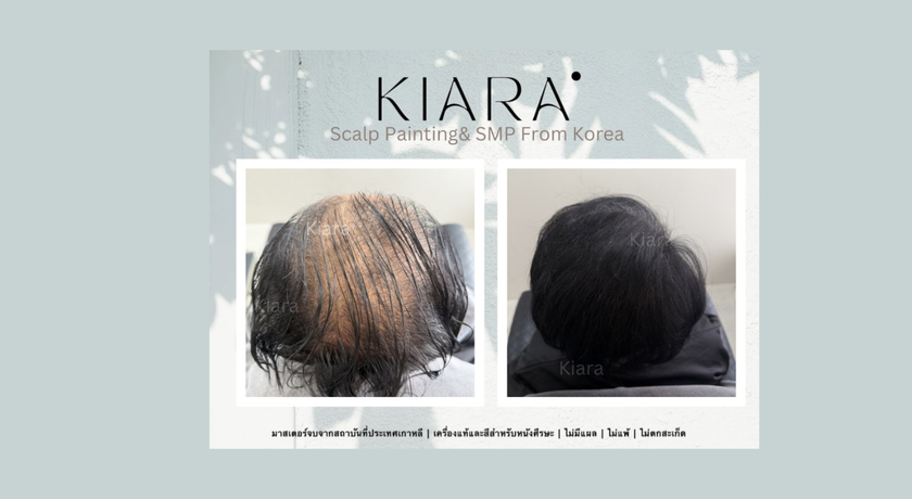 Kiara Scalp Painting (Ratchaphruek) Kiara Scalp Painting - เคียร์ร่า เพ้นท์สีผม ราชพฤกษ์ 4
