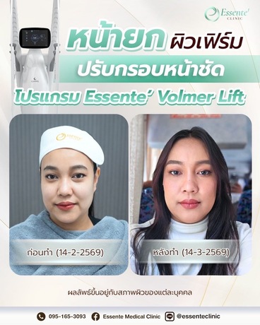 Essente Clinic (Sukhumvit 93) เอสเซนเต้ คลินิกเวชกรรม (สุขุมวิท 93) image_picker_E9D15AEA-BBC7-4FFA-B100-C10C8BB0BBD5-34467-000013AF0BE55A8F