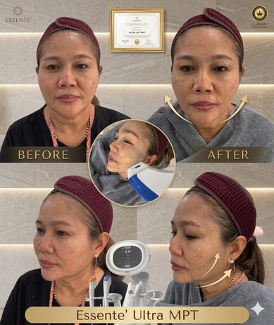Essente Clinic (Sukhumvit 93) เอสเซนเต้ คลินิกเวชกรรม (สุขุมวิท 93) image_picker_2C6723FF-6DAE-48D2-9EB2-6B6A7CBB47A4-34467-000013AF5C852456