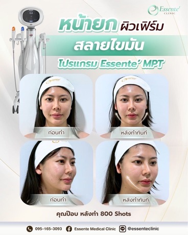 Essente Clinic (Sukhumvit 93) เอสเซนเต้ คลินิกเวชกรรม (สุขุมวิท 93) image_picker_5E6EEE0B-FCDA-47A6-AB61-6B57F75207DD-34467-000013AF5C8F1720