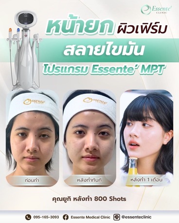Essente Clinic (Sukhumvit 93) เอสเซนเต้ คลินิกเวชกรรม (สุขุมวิท 93) image_picker_06795CD4-F437-49B7-93E6-E11AD89A6812-34467-000013AF5CA40491