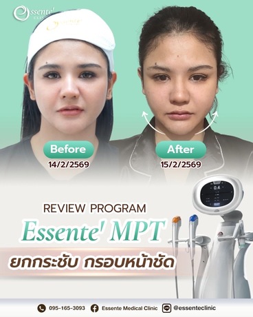 Essente Clinic (Sukhumvit 93) เอสเซนเต้ คลินิกเวชกรรม (สุขุมวิท 93) image_picker_F7FAE53F-C44D-4D50-9533-C7767C956C84-34467-000013AF5C955540