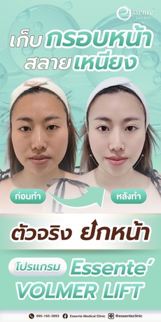 Essente Clinic (Sukhumvit 93) เอสเซนเต้ คลินิกเวชกรรม (สุขุมวิท 93) image_picker_DAF7B2B7-E1A2-4328-825B-99F436BFCE33-34467-000013AF7B789092