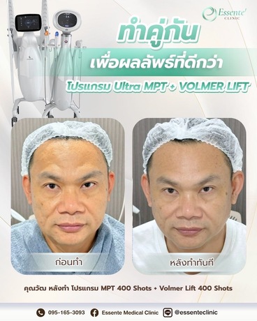 Essente Clinic (Sukhumvit 93) เอสเซนเต้ คลินิกเวชกรรม (สุขุมวิท 93) image_picker_5D8B1093-4222-47A9-B74A-5A1611543A7C-34467-000013AF7B8C6287