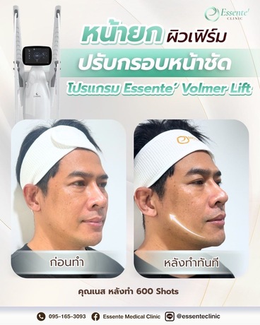 Essente Clinic (Sukhumvit 93) เอสเซนเต้ คลินิกเวชกรรม (สุขุมวิท 93) image_picker_1CFB4BED-6260-4764-86F5-50DE40277ED0-34467-000013AF7B96D4B5