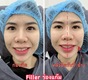 image_picker_EE6A6313-3C2B-46A1-8F9D-BE3670A1A109-4711-0000019B231F6785