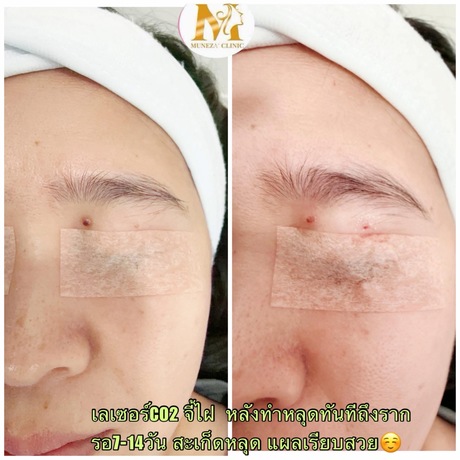 Muneza’ Clinic  image_picker_FFE6C66B-E061-431A-9C5B-451F1E1F9145-4711-0000019B23155682