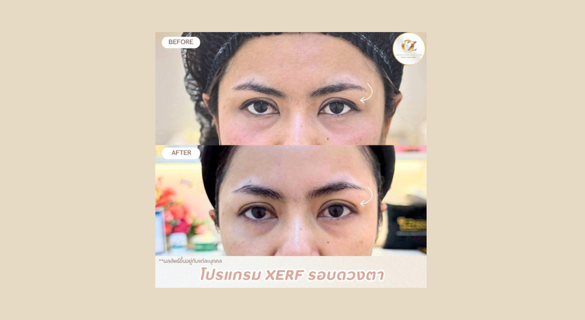 Ozona Wellnesz Clinic Ozona Wellnesz Clinic - โอโซน่าเวลเนสคลินิก คลินิกความงาม ชุมพร 7